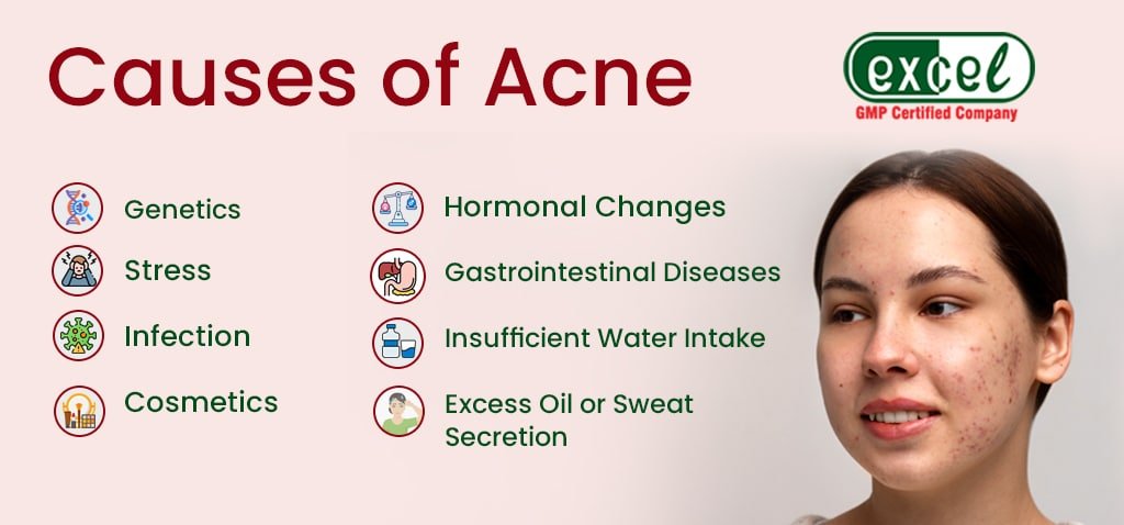 Homeopathic Medicine for Pimple