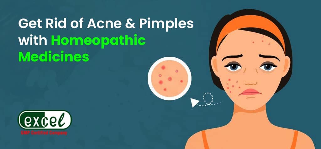 Homeopathy Medicine For Acne