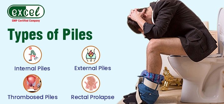 Types of Piles