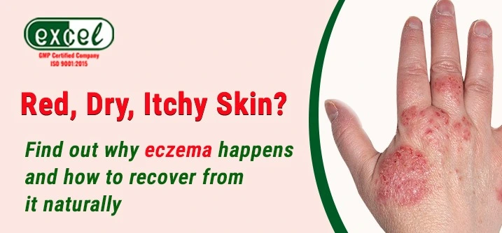 homeopathy and eczema