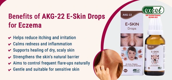 is eczema contagious